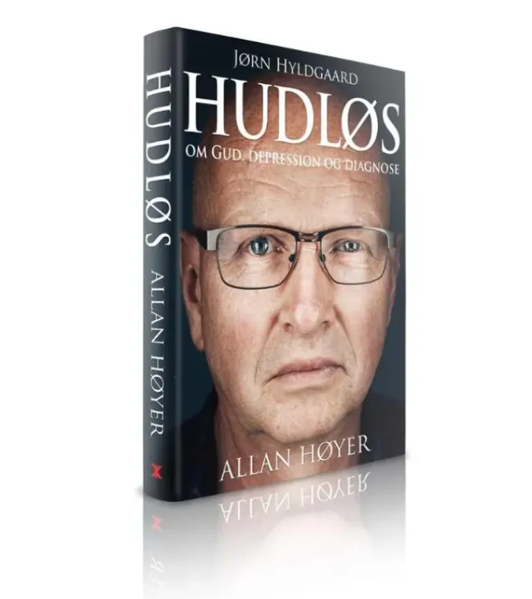 Hudløs